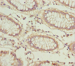 LARS2 Antibody