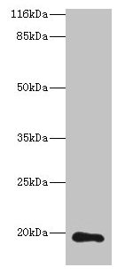 RAB30 Antibody