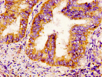 SCN9A Antibody