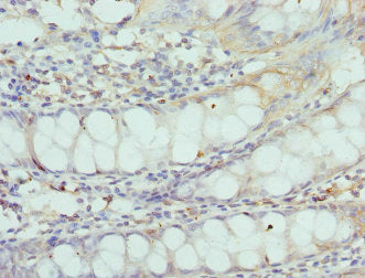 CNGA3 Antibody