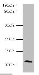 SSX2 Antibody
