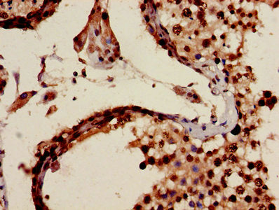 MIA Antibody