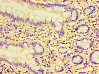 KYAT1 Antibody