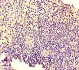 TIAM1 Antibody