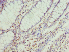 TRIM32 Antibody