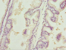 TRIM32 Antibody
