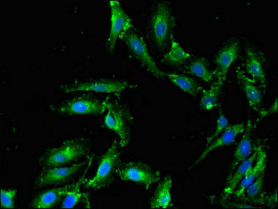 PLD1 Antibody