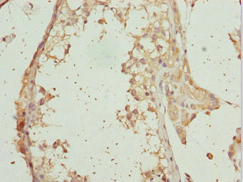 RAB31 Antibody