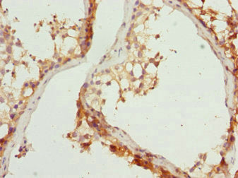 RAB31 Antibody
