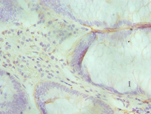 ALKBH1 Antibody