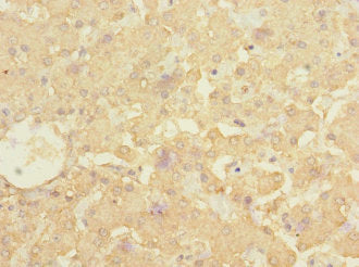 ALCAM Antibody