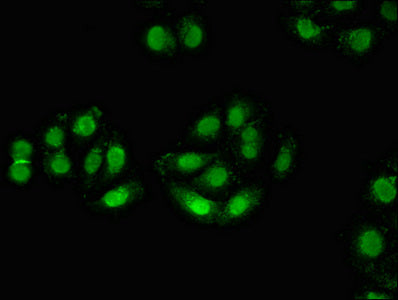 ZMYM3 Antibody