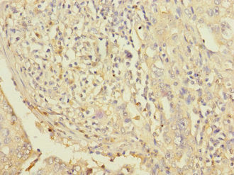 LPIN1 Antibody