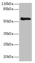 RBMY1F Antibody
