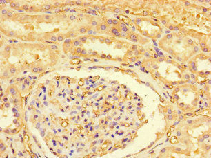 ZRSR2P1 Antibody
