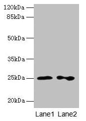RAB11B Antibody