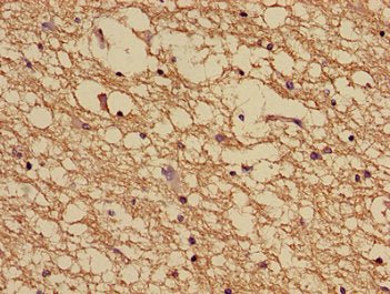 NDUFA5 Antibody