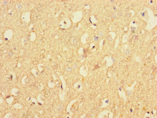 RAB40B Antibody