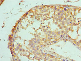 MAP2K5 Antibody