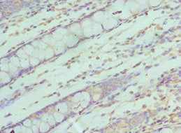 SF3B2 Antibody