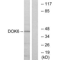 DOK6 Antibody