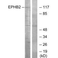 EPHB2 Antibody