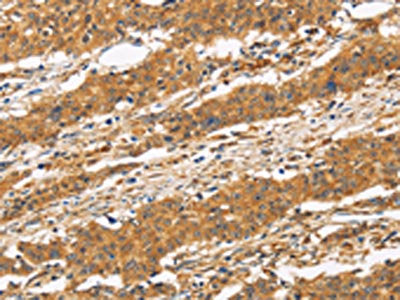 CD22 Antibody