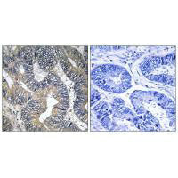 GTPBP2 Antibody