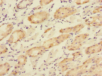 TOB2 Antibody