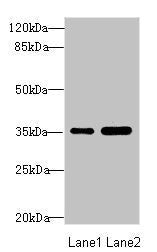 TOB2 Antibody