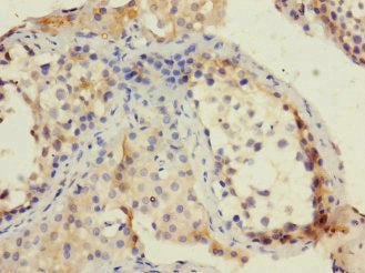 TRIP12 Antibody