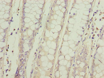 SPCS2 Antibody