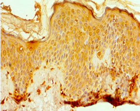 EFTUD2 Antibody