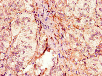 ACOX1 Antibody