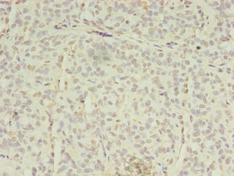 EPHA7 Antibody