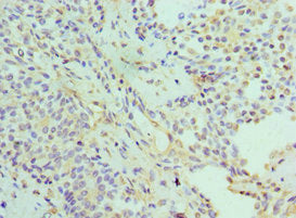PSMD5 Antibody