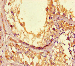 LPAL2 Antibody
