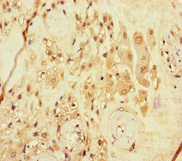 ARHGEF5 Antibody