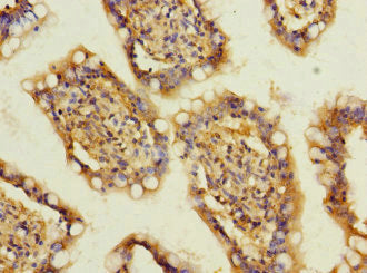 SLC13A2 Antibody