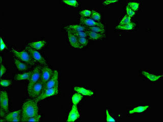 MADCAM1 Antibody