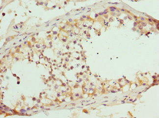 RASGRF1 Antibody