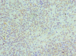 HNRNPD Antibody
