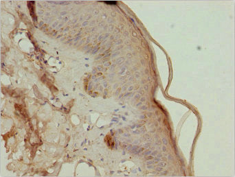 TRIM29 Antibody