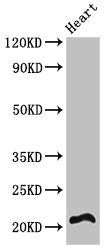RCAN2 Antibody