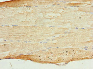 MYBPC2 Antibody