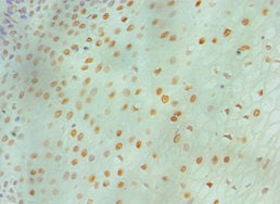 MCM6 Antibody