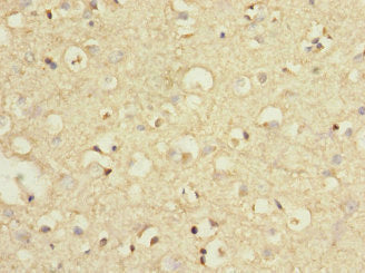 GRM7 Antibody
