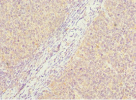 PCM1 Antibody