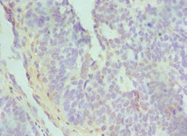 TGFBI Antibody