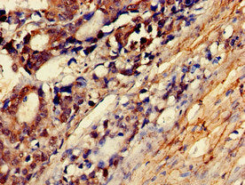MYLK Antibody